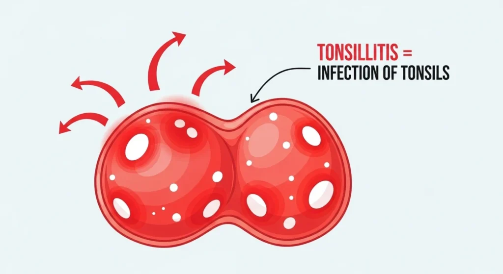 What Tonsillitis Means